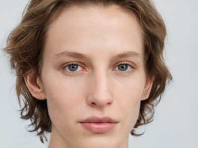 张梅英整形医生额头起痘痘去除技术风格各异-广州医科大学附属第二医院整形美容科