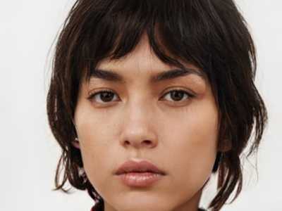 晋城市眼窝凹陷填充术医生哪些效果好-李茂群整形医生网评真不错